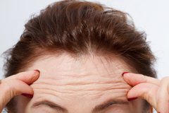 有抬头纹怎么办?怎样去除抬头纹