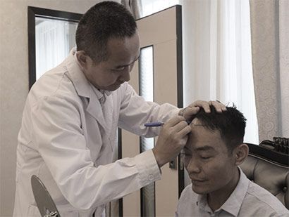 头发种植手术前设计