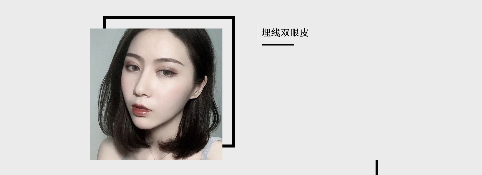 眼部整形手术方案