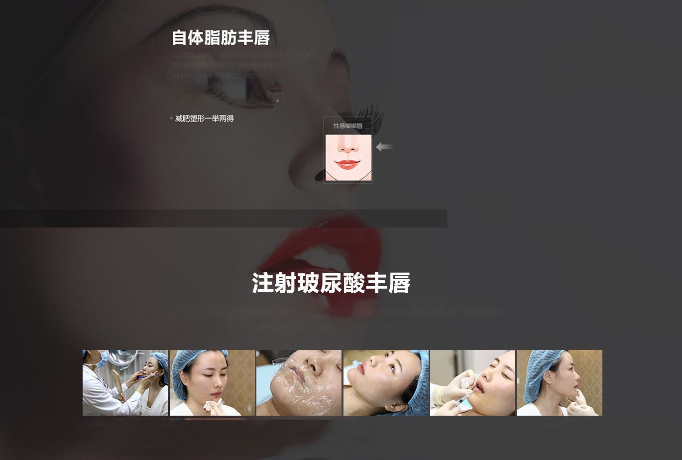 自体脂肪唇部整形方案