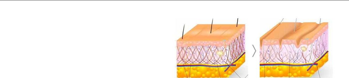 颈部青春美颈配方