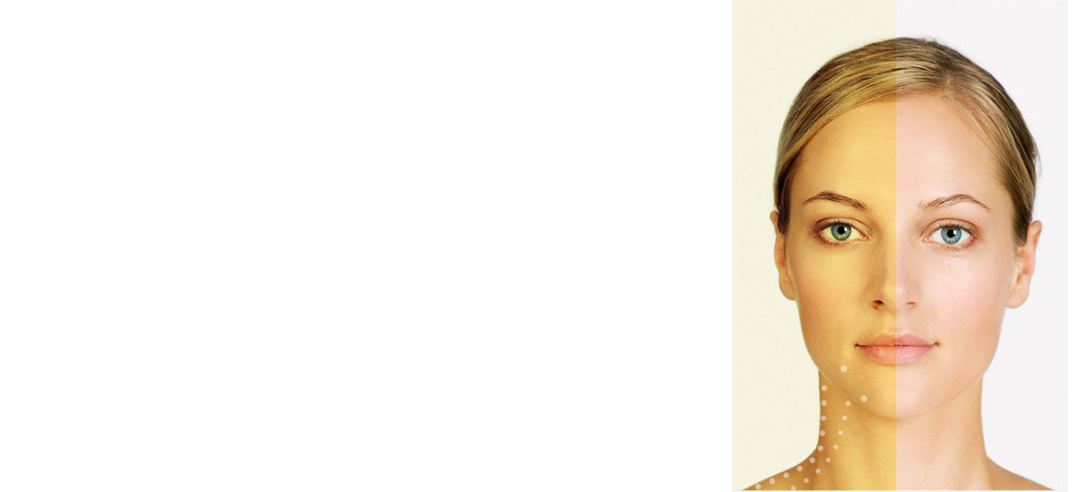 颈部整形注射范围