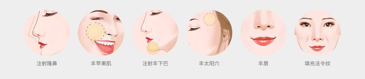 玻尿酸可以注射脸部哪些部位
